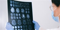 Vědci sledovali mozek v průběhu smrti. EEG naznačilo, že skutečně „promítne život před očima“