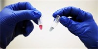 Revoluční test odhalí rakovinu ze vzorku krve za pouhých 10 minut